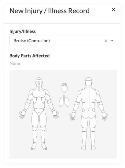 body parts diagram-parts affected.jpg